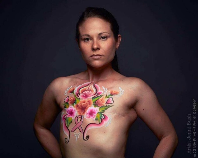 Jamie Kastelic - breast cancer survivor